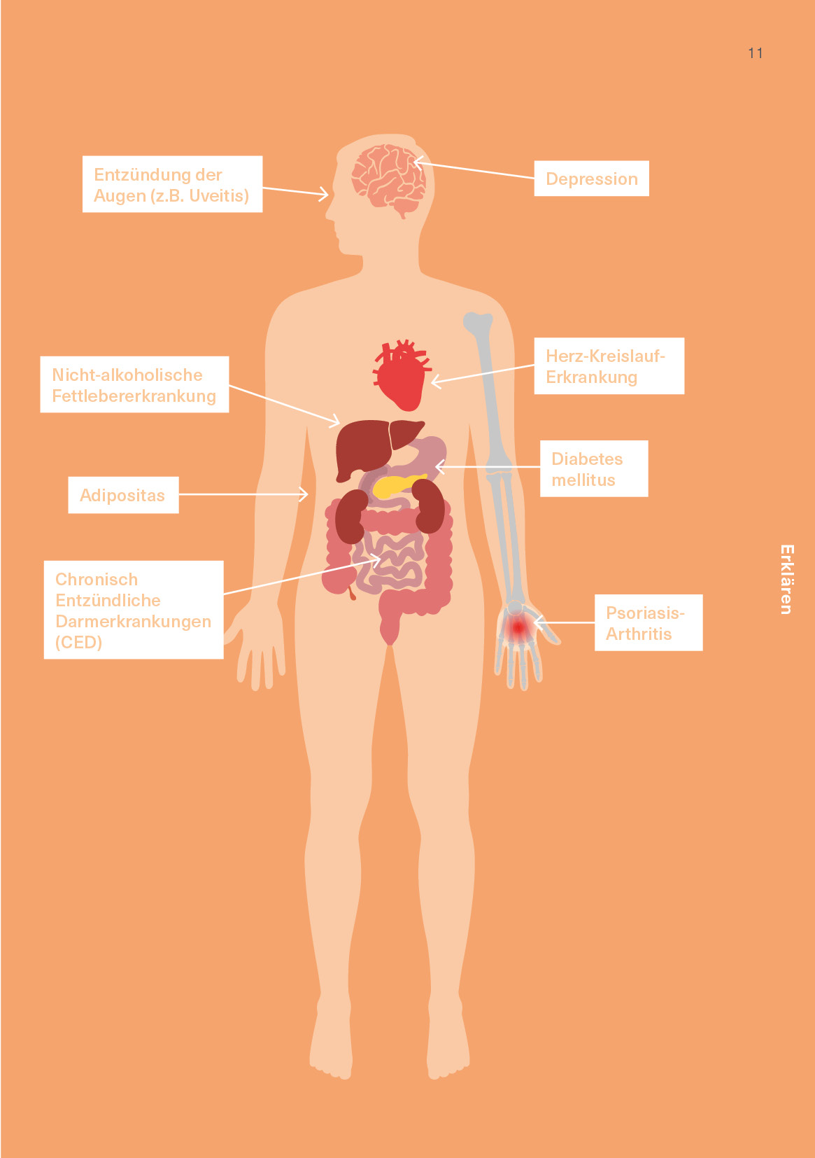 09_2025 AbbVie CH Psoriasis Patientenbroschüre Update_A5_v4_11